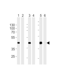 Invitrogen STEAP2 Polyclonal Antibody 400 &mu;L; Unconjugated:Antibodies,