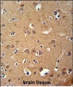 Invitrogen ZDHHC2 Polyclonal Antibody 400 &mu;L | Buy Online | Invitrogen&trade; | Fisher Scientific