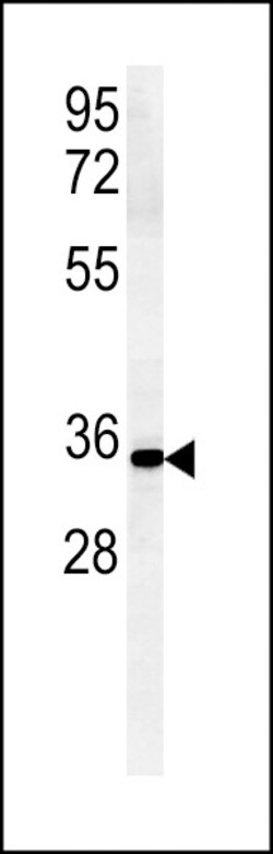 Invitrogen ZDHHC2 Polyclonal Antibody 400 &mu;L | Buy Online | Invitrogen&trade; | Fisher Scientific