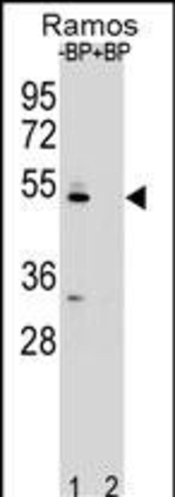 Invitrogen ZDHHC2 Polyclonal Antibody 400 &mu;L | Buy Online | Invitrogen&trade; | Fisher Scientific