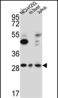 Invitrogen TAF1D Polyclonal Antibody 400 μL; Unconjugated:Antibodies,