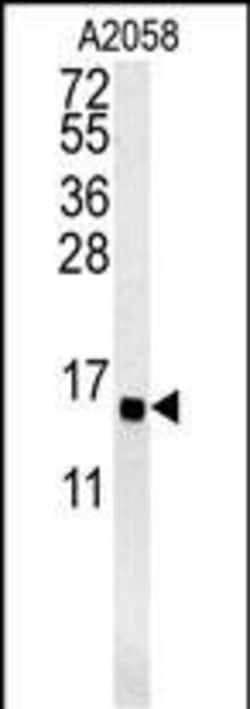 Invitrogen GOLT1A Polyclonal Antibody 400 &mu;L; Unconjugated:Antibodies,