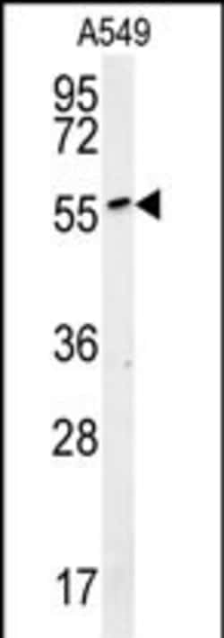 Invitrogen ALG10B Polyclonal Antibody 400 &mu;L; Unconjugated:Antibodies,