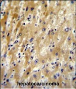 Invitrogen HABP2 Polyclonal Antibody 400 &mu;L; Unconjugated:Antibodies,
