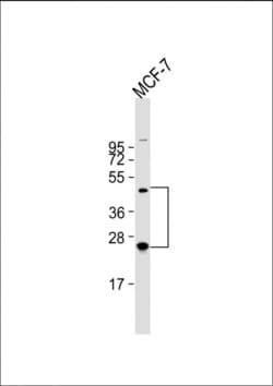 Invitrogen HABP2 Polyclonal Antibody 400 &mu;L; Unconjugated:Antibodies,