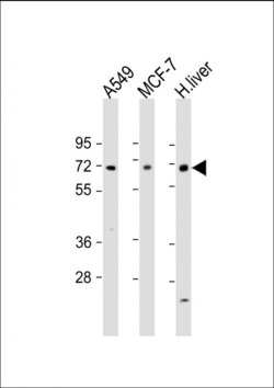 Invitrogen HABP2 Polyclonal Antibody 400 &mu;L; Unconjugated:Antibodies,