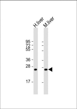 Invitrogen HABP2 Polyclonal Antibody 400 &mu;L; Unconjugated:Antibodies,