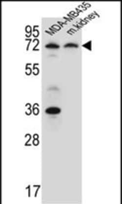 Invitrogen P2X7 Polyclonal Antibody 400 &mu;L; Unconjugated:Antibodies,