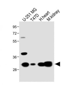 Invitrogen MARCH5 Polyclonal Antibody 400 &mu;L; Unconjugated:Antibodies,