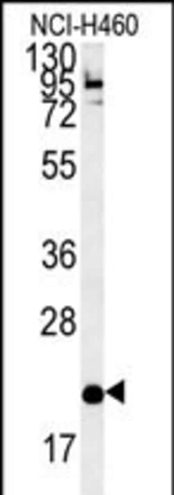 Invitrogen CRACC Polyclonal Antibody 400 μL; Unconjugated:Antibodies,