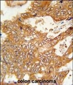 Invitrogen FBXO34 Polyclonal Antibody 400 &mu;L | Buy Online | Invitrogen&trade; | Fisher Scientific