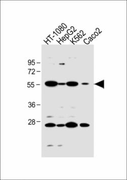 Invitrogen NTCP Polyclonal Antibody 200 &mu;L; Unconjugated:Antibodies,
