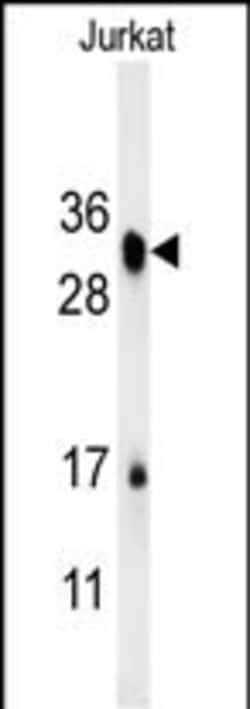 Invitrogen RSPO4 Polyclonal Antibody 400 &mu;L; Unconjugated:Antibodies