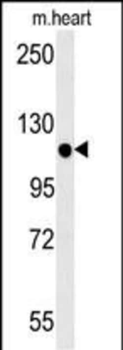 Invitrogen KIF24 Polyclonal Antibody 400 &mu;L; Unconjugated:Antibodies,