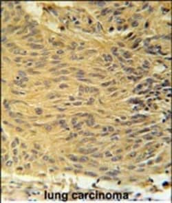 Invitrogen LCLAT1 Polyclonal Antibody 400 &mu;L; Unconjugated:Antibodies,