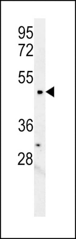 Invitrogen LCLAT1 Polyclonal Antibody 400 &mu;L; Unconjugated:Antibodies,