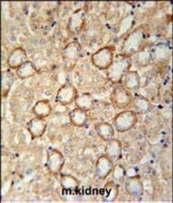 Invitrogen CRB2 Polyclonal Antibody 400 &mu;L | Buy Online | Invitrogen&trade; | Fisher Scientific