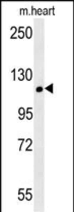 Invitrogen CRB2 Polyclonal Antibody 400 &mu;L | Buy Online | Invitrogen&trade; | Fisher Scientific