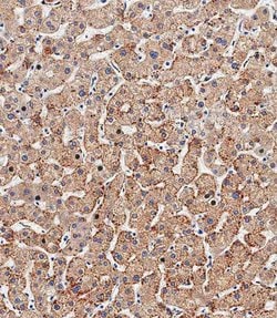 Invitrogen HSD17B13 Polyclonal Antibody 200 &mu;L; Unconjugated:Antibodies,