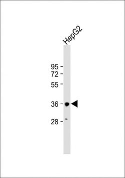 Invitrogen HSD17B13 Polyclonal Antibody 200 &mu;L; Unconjugated:Antibodies,