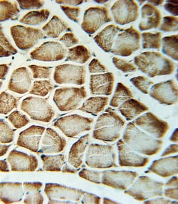 Invitrogen VLDLR Polyclonal Antibody 400 μL; Unconjugated:Antibodies,