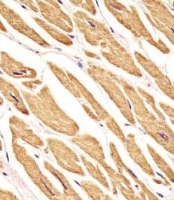 Invitrogen VLDLR Polyclonal Antibody 400 μL; Unconjugated:Antibodies,