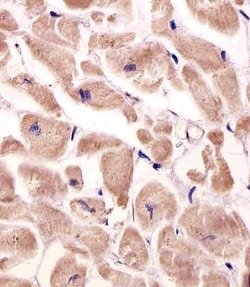 Invitrogen VLDLR Polyclonal Antibody 400 μL; Unconjugated:Antibodies,