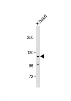 Invitrogen VLDLR Polyclonal Antibody 400 μL; Unconjugated:Antibodies,