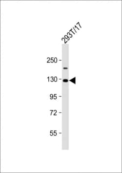 Invitrogen VLDLR Polyclonal Antibody 400 μL; Unconjugated:Antibodies,