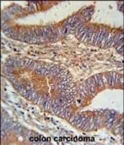 Invitrogen BIN2 Polyclonal Antibody 400 &mu;L; Unconjugated:Antibodies,