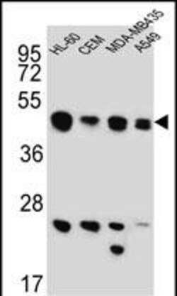 Invitrogen BIN2 Polyclonal Antibody 400 &mu;L; Unconjugated:Antibodies,