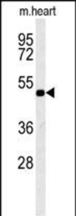 Invitrogen KCNV1 Polyclonal Antibody 400 &mu;L; Unconjugated:Antibodies,