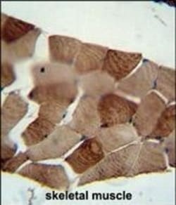 Invitrogen ST3GAL5 Polyclonal Antibody 400 &mu;L; Unconjugated:Antibodies,