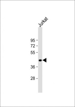 Invitrogen ST3GAL5 Polyclonal Antibody 400 &mu;L; Unconjugated:Antibodies,