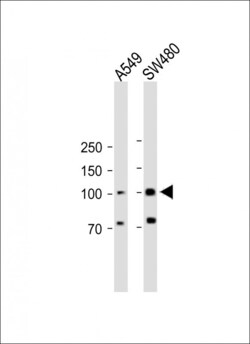 Invitrogen RASGRP1 Polyclonal Antibody 400 &mu;L | Buy Online | Invitrogen&trade; | Fisher Scientific