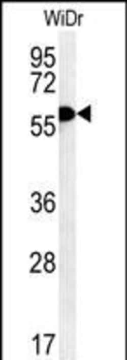 Invitrogen TANK Polyclonal Antibody 400 &mu;L; Unconjugated:Antibodies,