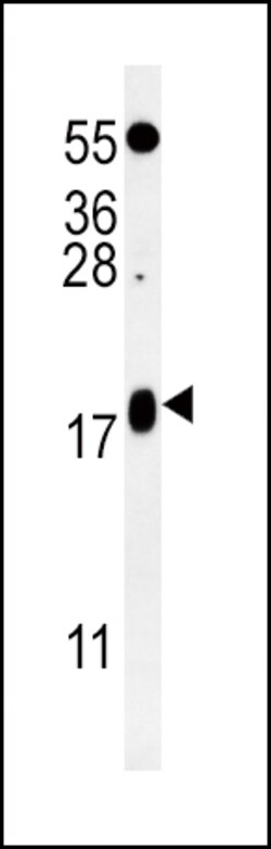 Invitrogen VAMP4 Polyclonal Antibody 400 &mu;L; Unconjugated:Antibodies,