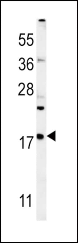 Invitrogen VAMP4 Polyclonal Antibody 400 &mu;L; Unconjugated:Antibodies,