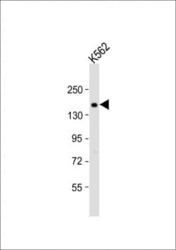 Invitrogen ADCY10 Polyclonal Antibody 400 &mu;L; Unconjugated:Antibodies,