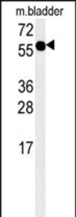 Invitrogen ADSSL1 Polyclonal Antibody 400 &mu;L; Unconjugated:Antibodies,