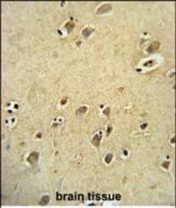 Invitrogen DIRAS3 Polyclonal Antibody 400 &mu;L; Unconjugated:Antibodies,