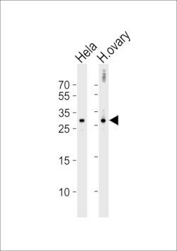 Invitrogen DIRAS3 Polyclonal Antibody 400 &mu;L; Unconjugated:Antibodies,