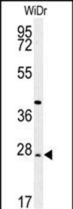 Invitrogen DIRAS3 Polyclonal Antibody 400 &mu;L; Unconjugated:Antibodies,