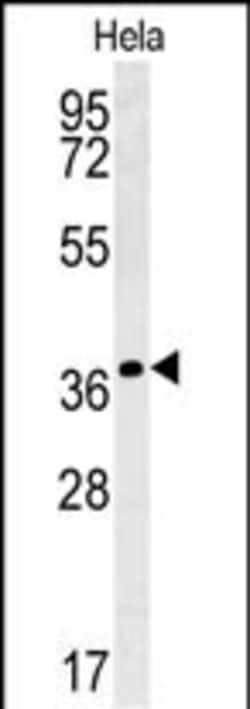 Invitrogen IL24 Polyclonal Antibody 400 &mu;L; Unconjugated:Antibodies,