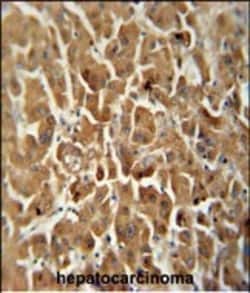 Invitrogen ATP5G2 Polyclonal Antibody 400 &mu;L | Buy Online | Invitrogen&trade; | Fisher Scientific