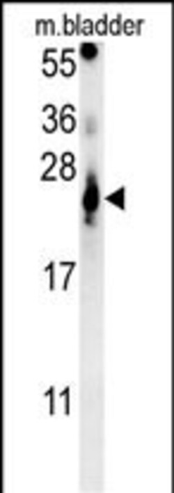 Invitrogen ATP5G2 Polyclonal Antibody 400 &mu;L | Buy Online | Invitrogen&trade; | Fisher Scientific