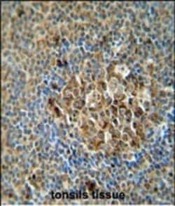 Invitrogen ACSF3 Polyclonal Antibody 400 &mu;L; Unconjugated:Antibodies,
