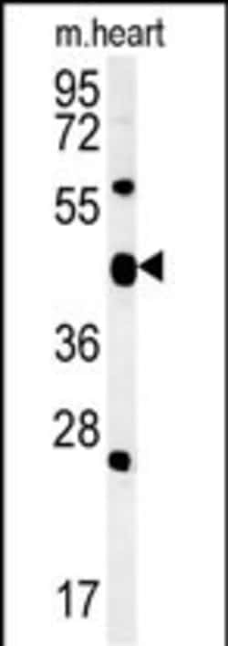 Invitrogen ACSF3 Polyclonal Antibody 400 &mu;L; Unconjugated:Antibodies,