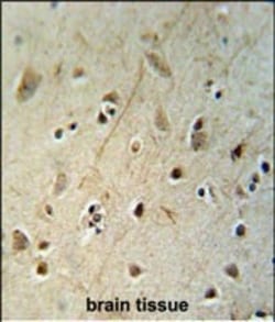 Invitrogen HEY2 Polyclonal Antibody 400 &mu;L; Unconjugated:Antibodies,