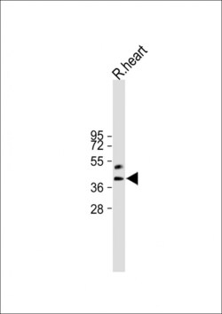 Invitrogen HEY2 Polyclonal Antibody 400 &mu;L; Unconjugated:Antibodies,